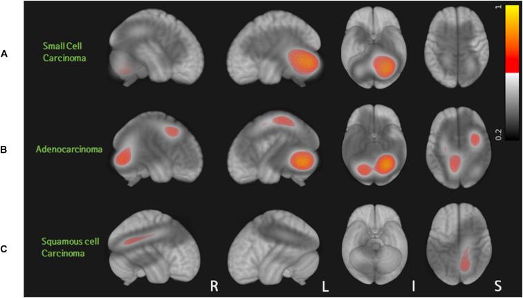 https://cdn.ncbi.nlm.nih.gov/pmc/blobs/e4ca/7484698/a15b9883c212/fonc-10-01664-g002.jpg