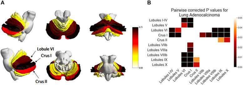 https://cdn.ncbi.nlm.nih.gov/pmc/blobs/e4ca/7484698/d98555f70c8b/fonc-10-01664-g005.jpg