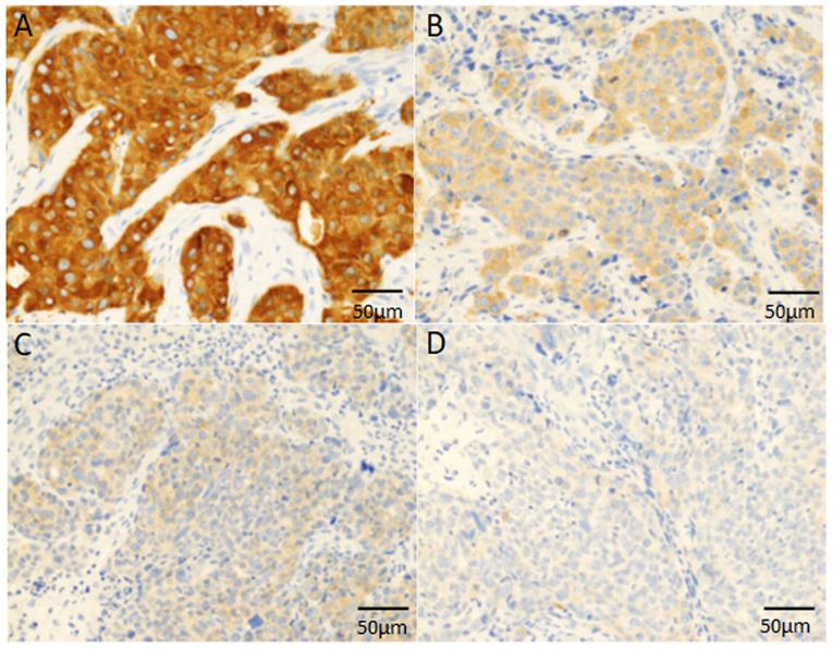 https://cdn.ncbi.nlm.nih.gov/pmc/blobs/e4d3/8892429/e02d90a9443b/mco-16-04-02513-g00.jpg