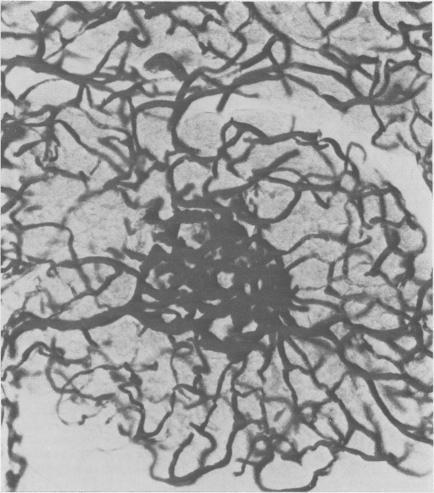 https://cdn.ncbi.nlm.nih.gov/pmc/blobs/e4d5/1419227/c89402e56b9c/gut00423-0089-a.jpg