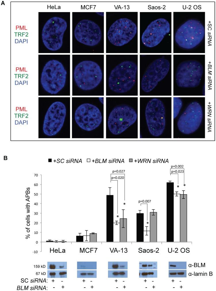https://cdn.ncbi.nlm.nih.gov/pmc/blobs/e4d7/3977986/14310673590c/pone.0093991.g003.jpg