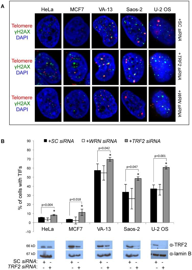 https://cdn.ncbi.nlm.nih.gov/pmc/blobs/e4d7/3977986/e0646ae00ed0/pone.0093991.g005.jpg