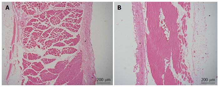 https://cdn.ncbi.nlm.nih.gov/pmc/blobs/e4e3/5374128/7bbbcffc735b/WJG-23-2168-g004.jpg