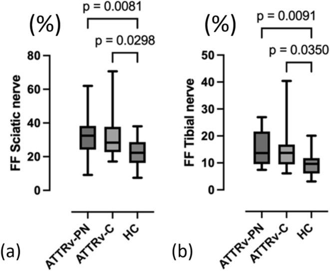 https://cdn.ncbi.nlm.nih.gov/pmc/blobs/e4e7/12010196/96975c37b98c/ENE-32-e70168-g004.jpg