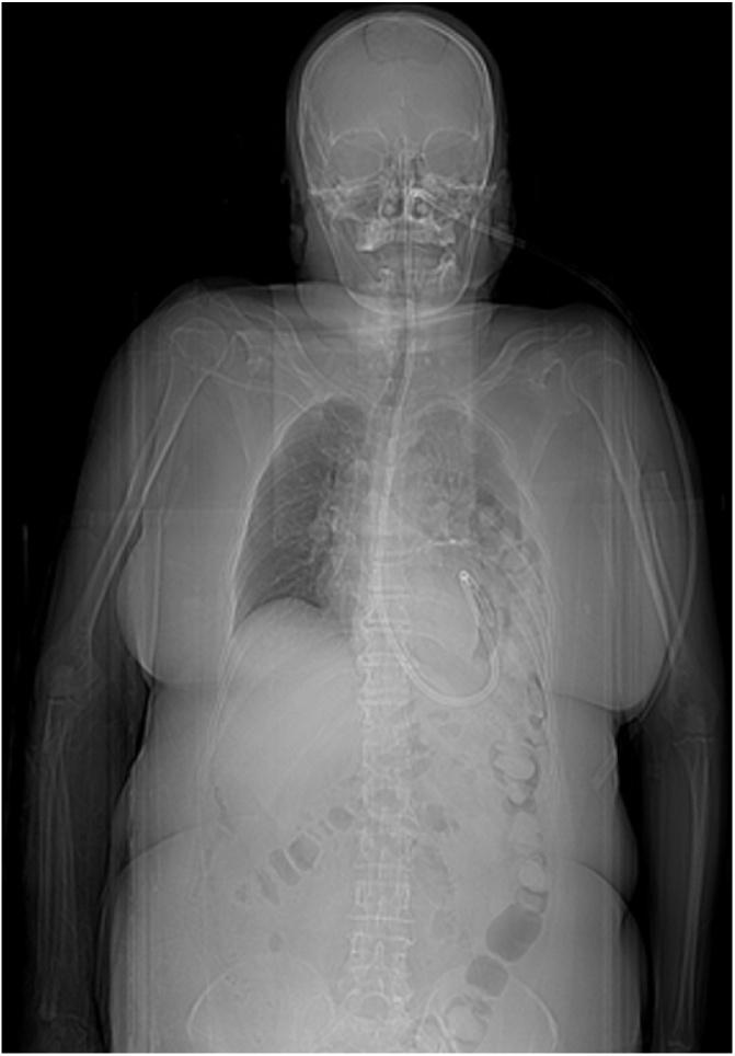 https://cdn.ncbi.nlm.nih.gov/pmc/blobs/e4e9/6664163/411bd74b9ec8/gr1.jpg