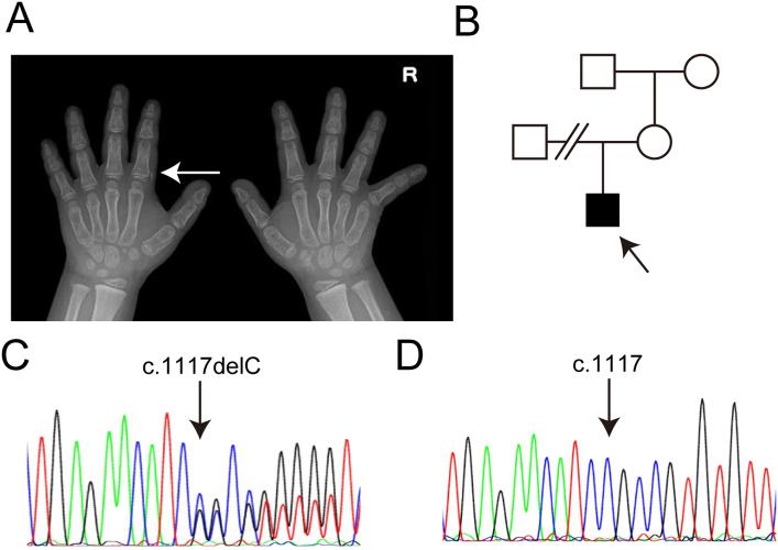 https://cdn.ncbi.nlm.nih.gov/pmc/blobs/e4ed/9668531/fe6525ca3643/gr2.jpg