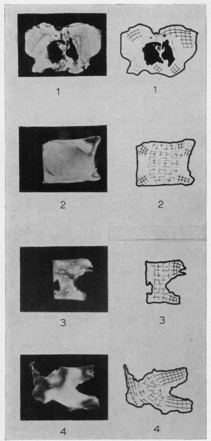 https://cdn.ncbi.nlm.nih.gov/pmc/blobs/e4ef/1006507/47aa5c1156a1/annrheumd00032-0063-a.jpg