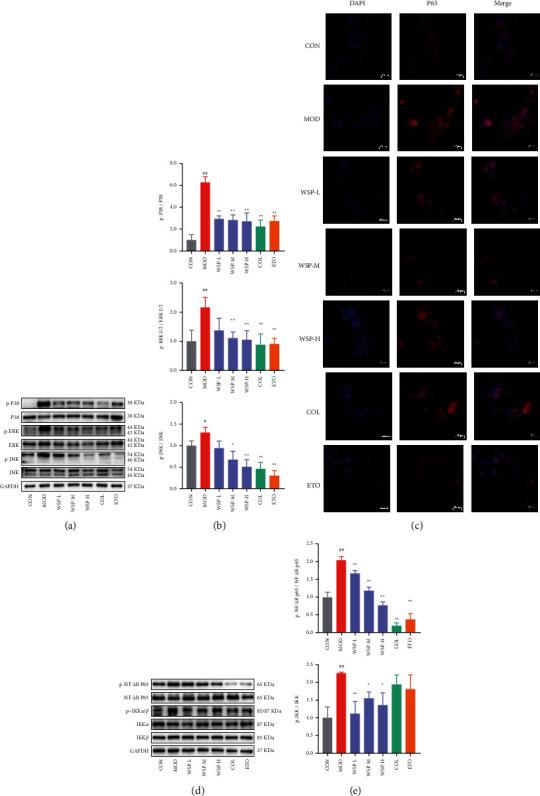 https://cdn.ncbi.nlm.nih.gov/pmc/blobs/e4f0/9568303/14d44fc013e1/ECAM2022-2377692.007.jpg