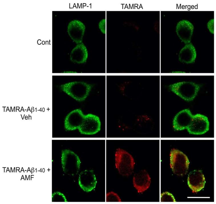 https://cdn.ncbi.nlm.nih.gov/pmc/blobs/e4f3/9180170/da1ce2734ed6/ijms-23-05885-g005.jpg