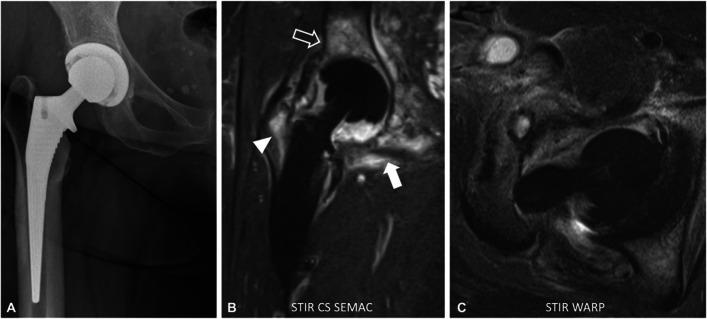 https://cdn.ncbi.nlm.nih.gov/pmc/blobs/e4fa/11303499/87e5772ddadf/256_2024_4624_Fig6_HTML.jpg