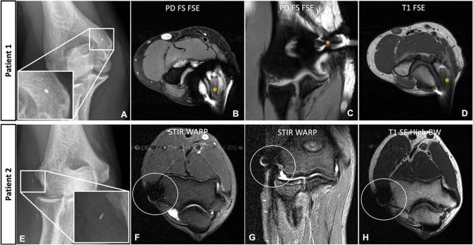 https://cdn.ncbi.nlm.nih.gov/pmc/blobs/e4fa/11303499/b6b0b09d08d8/256_2024_4624_Fig2_HTML.jpg
