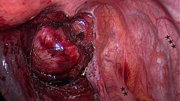 https://cdn.ncbi.nlm.nih.gov/pmc/blobs/e500/4189049/7740ff7242d5/gr3.jpg