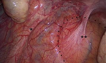 https://cdn.ncbi.nlm.nih.gov/pmc/blobs/e500/4189049/98bb8a70460e/gr2.jpg