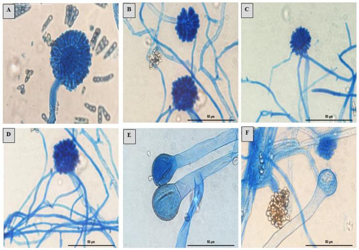 https://cdn.ncbi.nlm.nih.gov/pmc/blobs/e508/10820596/4cd6b28e5657/jof-10-00064-g009.jpg