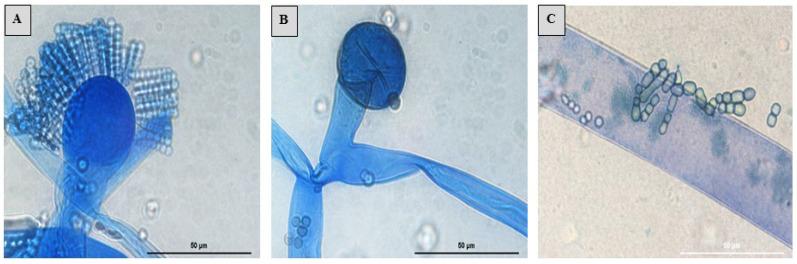 https://cdn.ncbi.nlm.nih.gov/pmc/blobs/e508/10820596/a88dac8e10d9/jof-10-00064-g007.jpg
