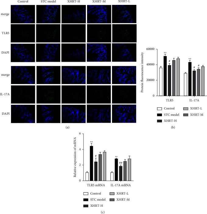https://cdn.ncbi.nlm.nih.gov/pmc/blobs/e50d/9870700/20a671b29839/ECAM2023-6506244.008.jpg