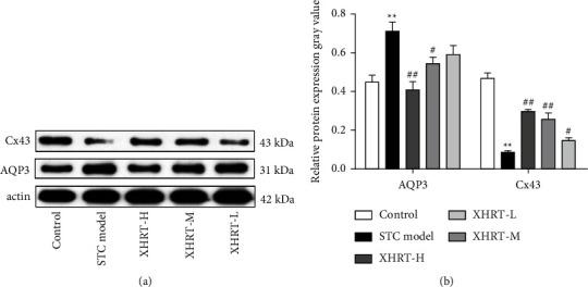 https://cdn.ncbi.nlm.nih.gov/pmc/blobs/e50d/9870700/667903d9bda8/ECAM2023-6506244.007.jpg