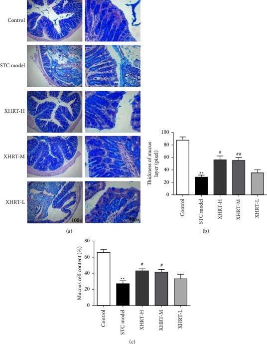 https://cdn.ncbi.nlm.nih.gov/pmc/blobs/e50d/9870700/cdbb15eef751/ECAM2023-6506244.003.jpg