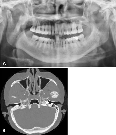 https://cdn.ncbi.nlm.nih.gov/pmc/blobs/e50f/3189534/15318b857ba1/isd-41-107-g007.jpg