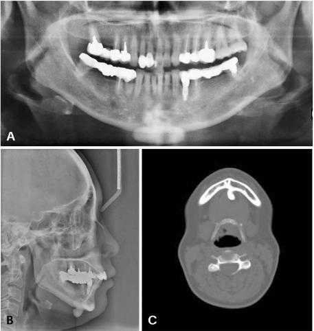 https://cdn.ncbi.nlm.nih.gov/pmc/blobs/e50f/3189534/bf5c45e53f9c/isd-41-107-g001.jpg