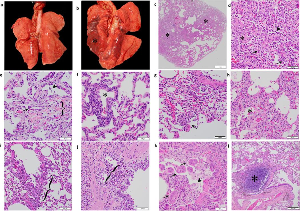 https://cdn.ncbi.nlm.nih.gov/pmc/blobs/e511/7890948/087bce7f095b/nihms-1649317-f0012.jpg