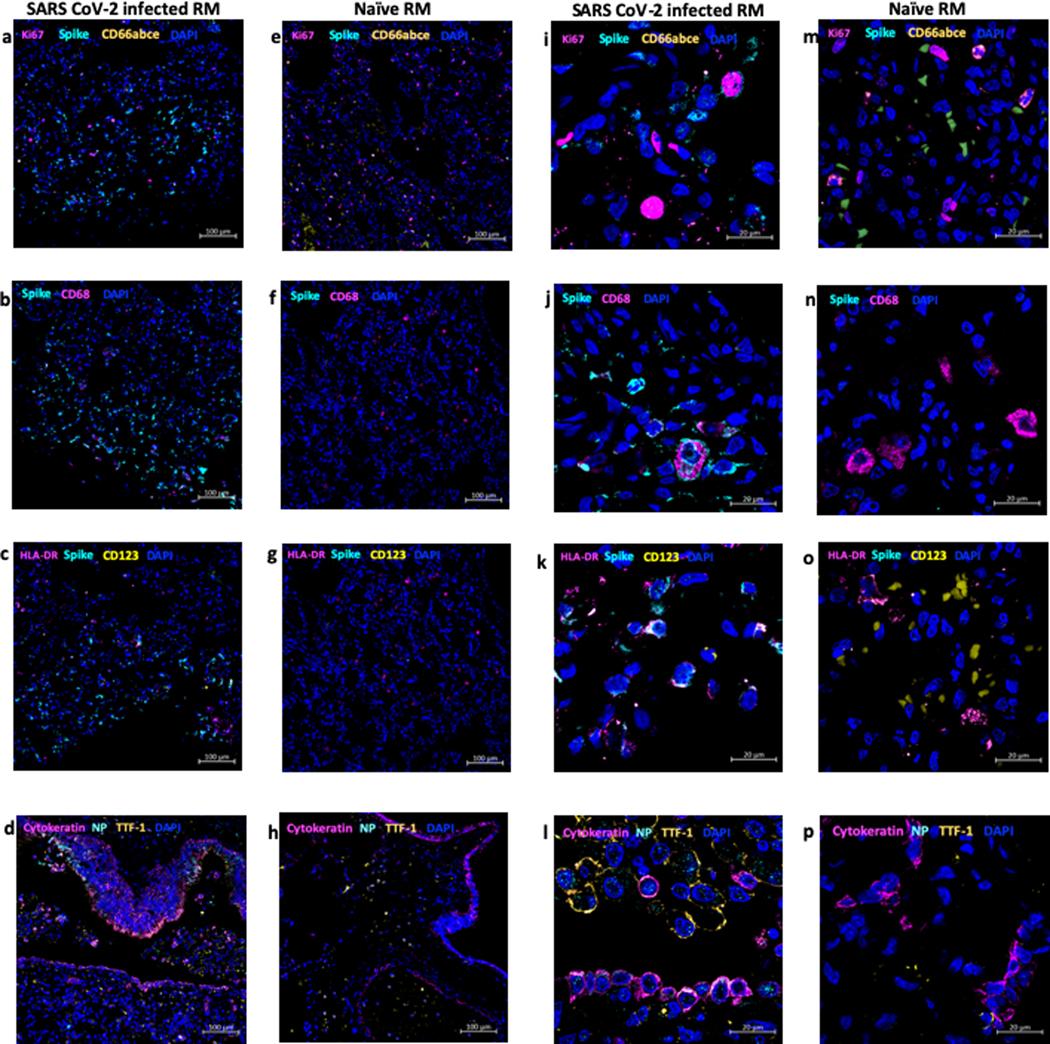 https://cdn.ncbi.nlm.nih.gov/pmc/blobs/e511/7890948/2733ee86df20/nihms-1649317-f0015.jpg