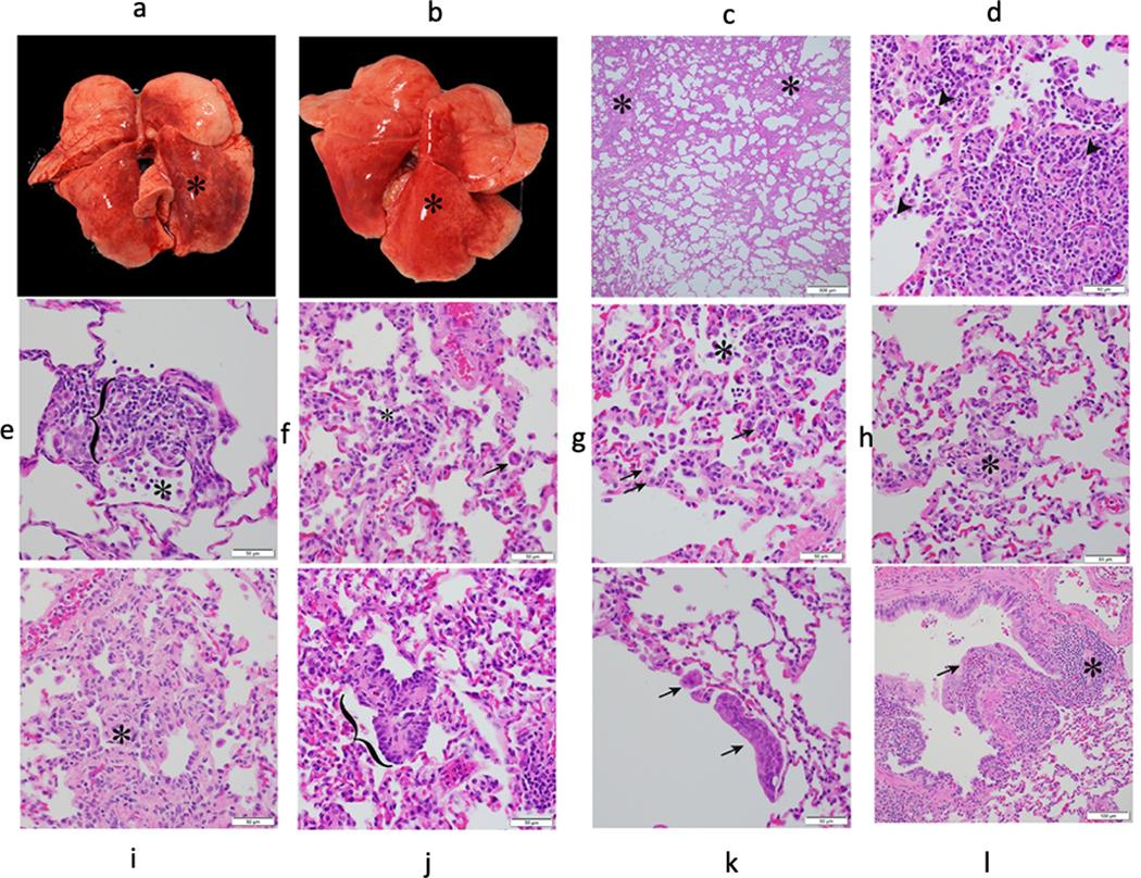 https://cdn.ncbi.nlm.nih.gov/pmc/blobs/e511/7890948/7b622bf9599c/nihms-1649317-f0009.jpg