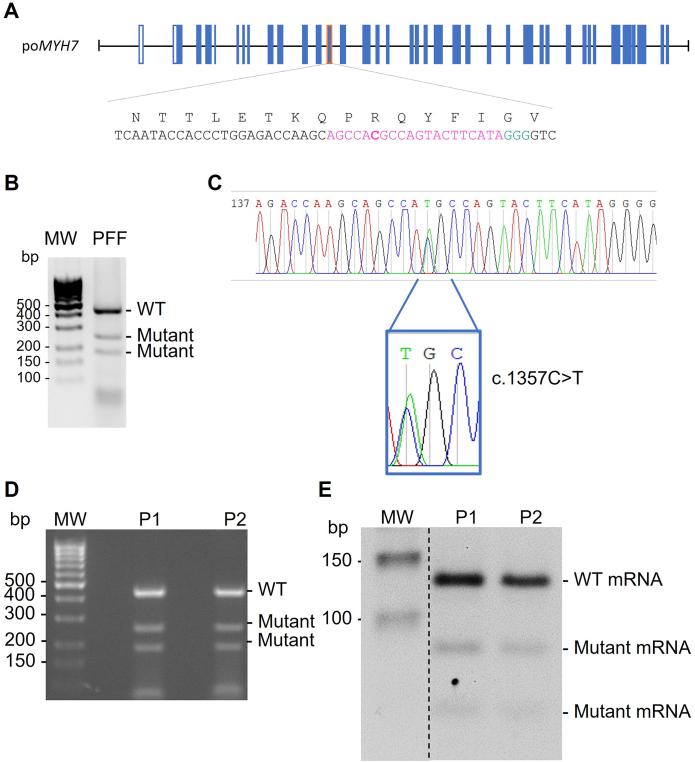 https://cdn.ncbi.nlm.nih.gov/pmc/blobs/e515/12151660/f4036011bfcc/gr3.jpg