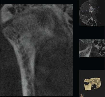 https://cdn.ncbi.nlm.nih.gov/pmc/blobs/e517/4319332/6abb45679f07/CCD-6-124-g005.jpg