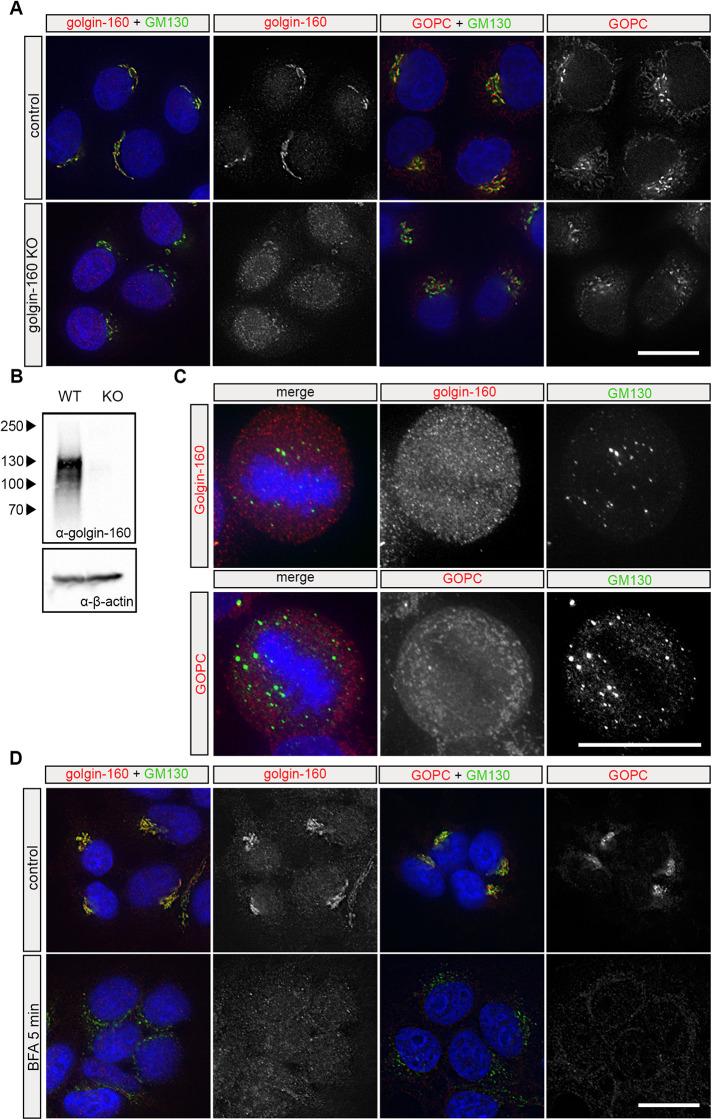 https://cdn.ncbi.nlm.nih.gov/pmc/blobs/e51d/9582621/af72f10e2491/mbc-33-ar86-g005.jpg