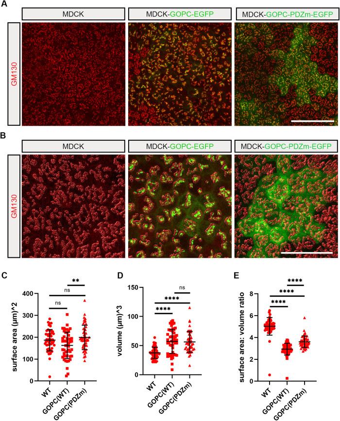https://cdn.ncbi.nlm.nih.gov/pmc/blobs/e51d/9582621/cc36bd507fe7/mbc-33-ar86-g006.jpg
