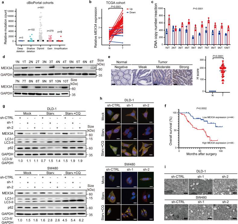 https://cdn.ncbi.nlm.nih.gov/pmc/blobs/e520/10987644/5ee31a5d137a/41392_2024_1787_Fig1_HTML.jpg