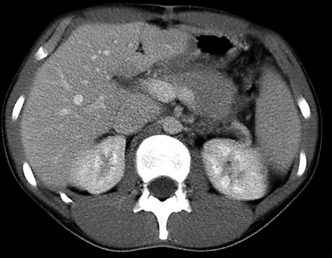 https://cdn.ncbi.nlm.nih.gov/pmc/blobs/e524/3075161/4c41f8adac50/crg0002-0022-f02.jpg