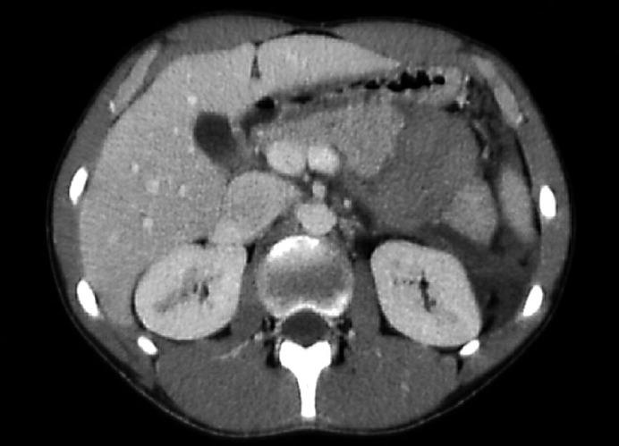 https://cdn.ncbi.nlm.nih.gov/pmc/blobs/e524/3075161/887fb8e1cd8b/crg0002-0022-f01.jpg