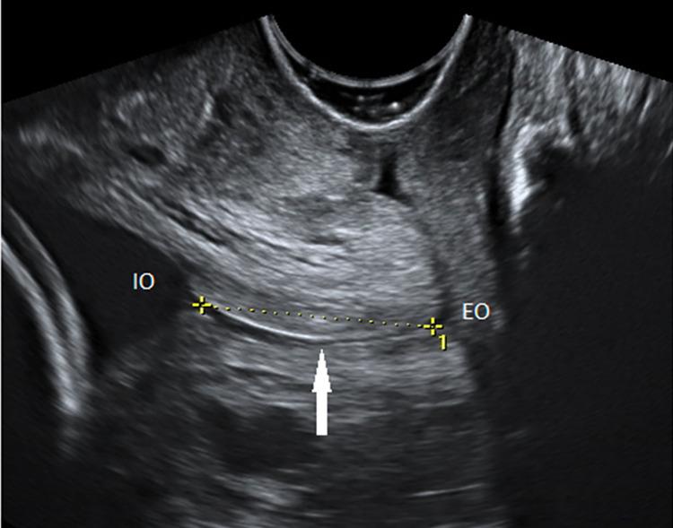 https://cdn.ncbi.nlm.nih.gov/pmc/blobs/e529/9544154/de4e352d5030/pone.0272128.g001.jpg