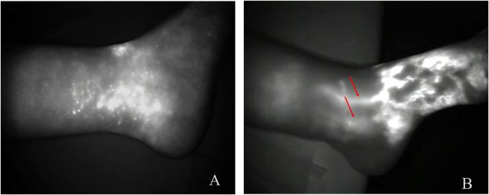 https://cdn.ncbi.nlm.nih.gov/pmc/blobs/e52e/11751497/44b771672286/gr5.jpg