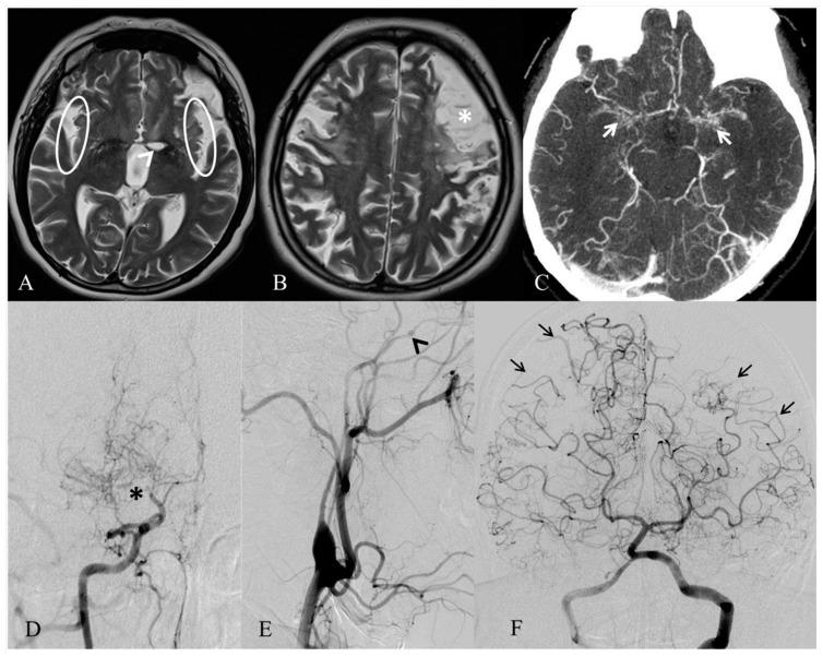 https://cdn.ncbi.nlm.nih.gov/pmc/blobs/e530/6274901/112a794f235b/ijms-19-03675-g001.jpg