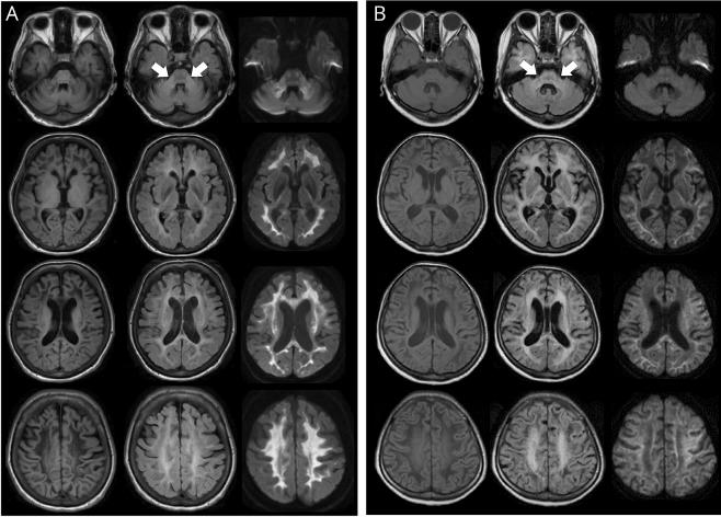 https://cdn.ncbi.nlm.nih.gov/pmc/blobs/e537/6340331/e57cde6b3917/NG2018008144FF3.jpg