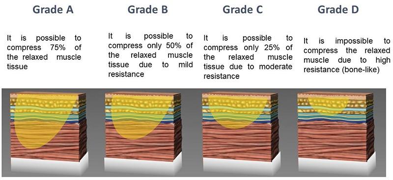 https://cdn.ncbi.nlm.nih.gov/pmc/blobs/e53b/6767937/f2e846746df1/ejtm-29-3-8476-g001.jpg