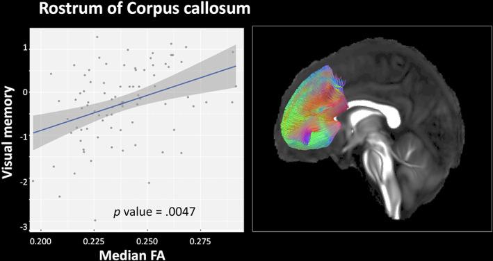 https://cdn.ncbi.nlm.nih.gov/pmc/blobs/e543/10171547/b529d0099ede/HBM-44-3045-g002.jpg