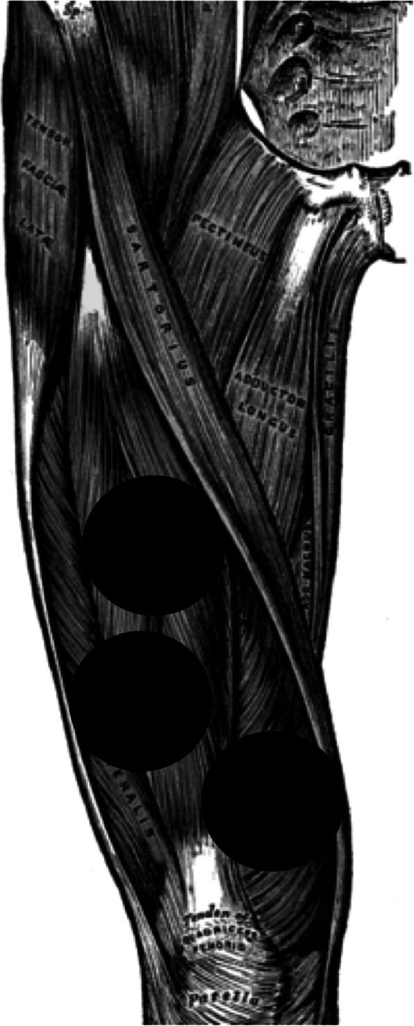 https://cdn.ncbi.nlm.nih.gov/pmc/blobs/e546/7574416/bbb1969ca284/13102_2020_214_Fig1_HTML.jpg