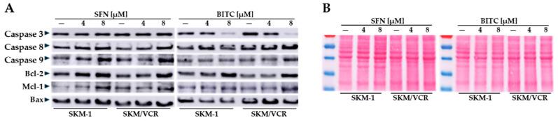https://cdn.ncbi.nlm.nih.gov/pmc/blobs/e551/11677715/4b55c6b83bb8/ijms-25-13511-g004.jpg