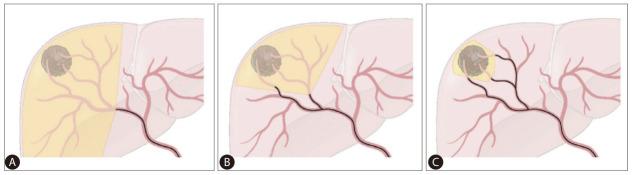 https://cdn.ncbi.nlm.nih.gov/pmc/blobs/e555/10366793/9281ff7ab80c/cmh-2023-0202f2.jpg