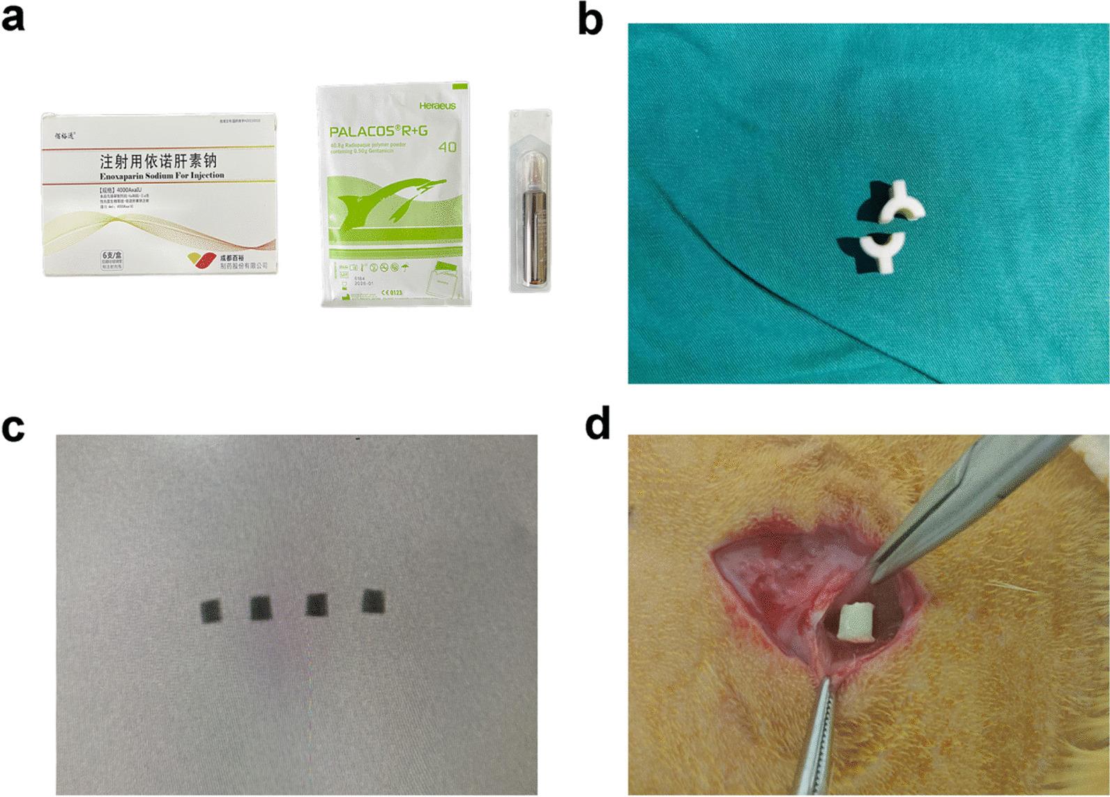 https://cdn.ncbi.nlm.nih.gov/pmc/blobs/e55c/10207791/b88ad76fc90e/13018_2023_3865_Fig1_HTML.jpg