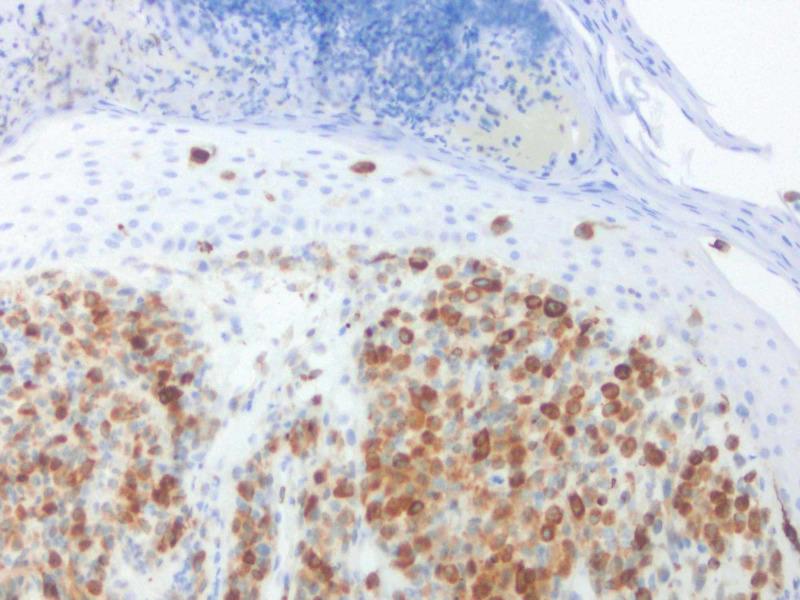 https://cdn.ncbi.nlm.nih.gov/pmc/blobs/e561/7500710/3e029751fa3e/cureus-0012-00000009861-i09.jpg