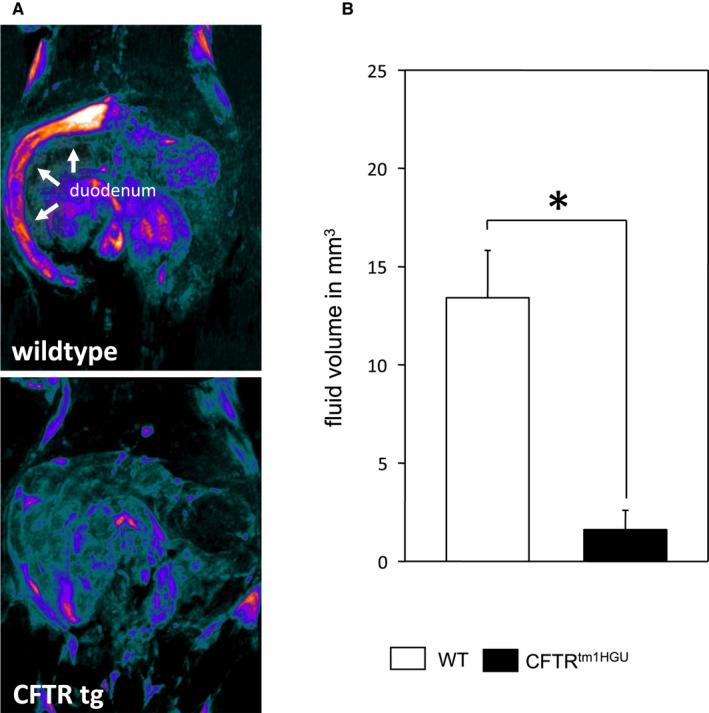 https://cdn.ncbi.nlm.nih.gov/pmc/blobs/e561/8107082/624cd1eaaaed/JCMM-25-4658-g005.jpg