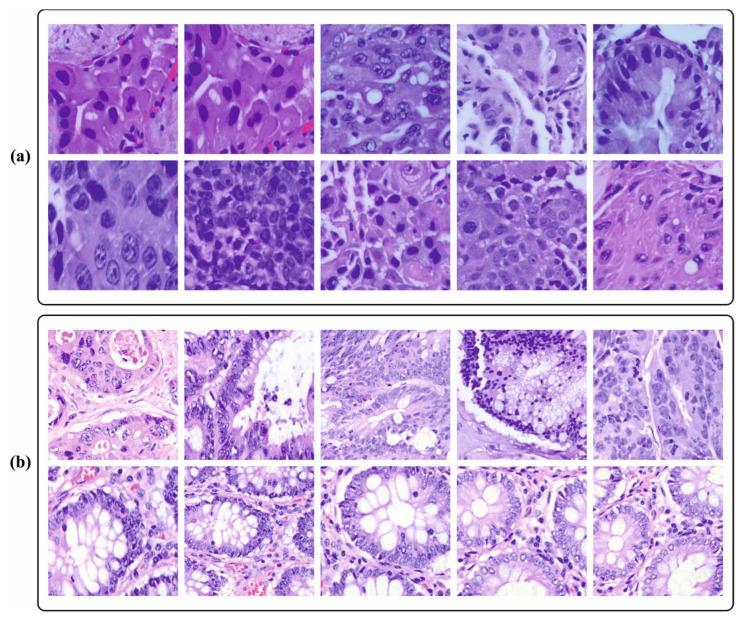 https://cdn.ncbi.nlm.nih.gov/pmc/blobs/e569/10340056/d15af65b495e/cancers-15-03300-g003.jpg