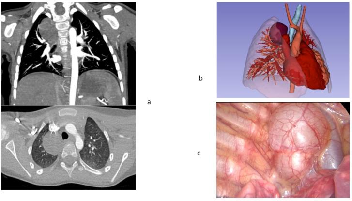 https://cdn.ncbi.nlm.nih.gov/pmc/blobs/e570/8774663/6d920db3e5d1/children-09-00050-g003.jpg