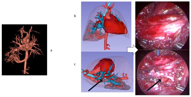 https://cdn.ncbi.nlm.nih.gov/pmc/blobs/e570/8774663/9512409f33f7/children-09-00050-g002.jpg