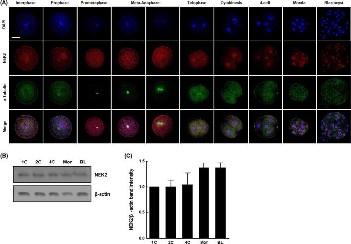 https://cdn.ncbi.nlm.nih.gov/pmc/blobs/e573/11294417/cd874f940f12/CPR-57-e13626-g009.jpg